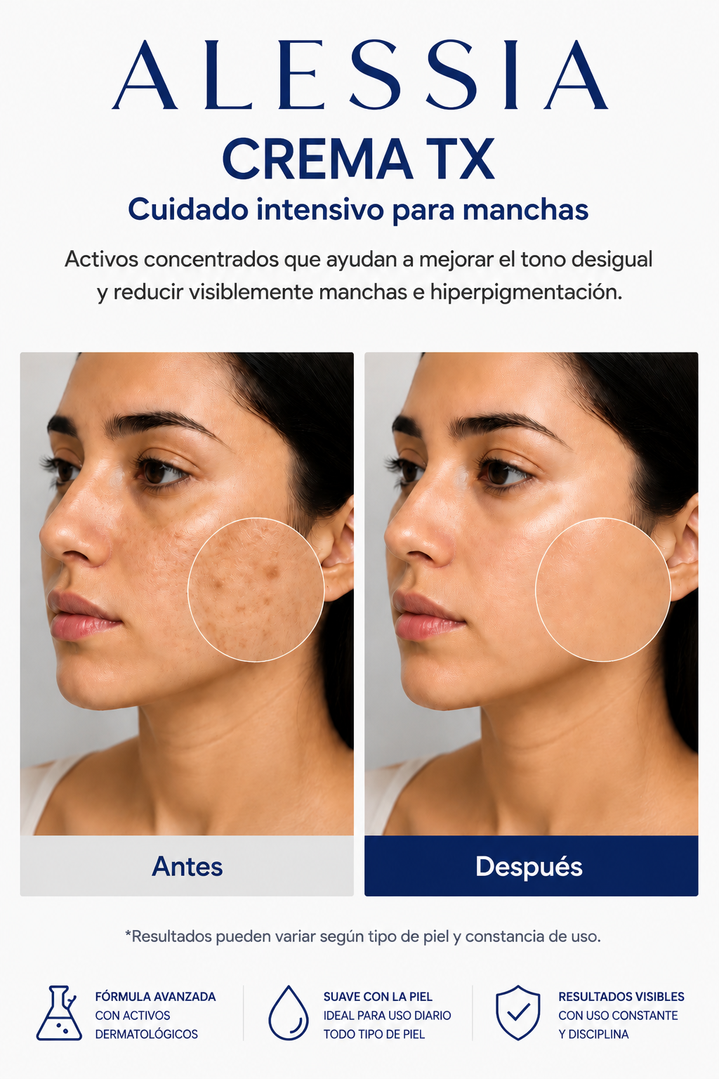 ALESSIA Crema TX Anti-Manchas | Reduce Marcas, Unifica el Tono y Mejora tu Piel